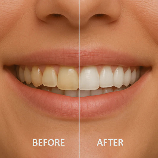 (😍Kúp 1 a získajte 1 zadarmo🔥)Nano (n-Ha) zubná pasta