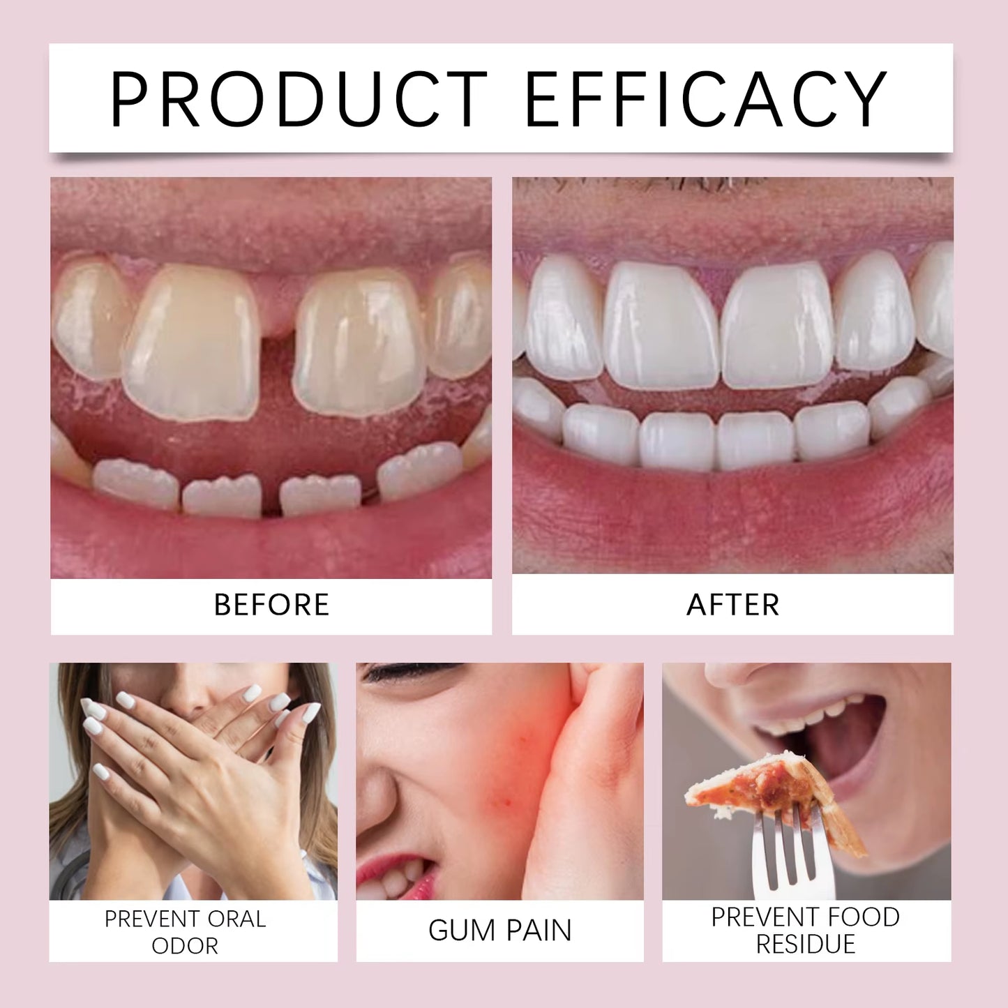 (🔥Kúp 1 a získajte 2 zadarmo🔥)Voľný, teplý, plyšový pyžamový set pre ženy, koralová No more loose dentures! Europe’s best-selling long-lasting denture adhesive?farba